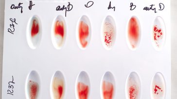 Why Is It Important To Know Your Blood Type?