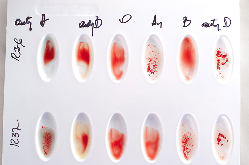 Why Is It Important To Know Your Blood Type?