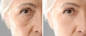 10 Foods That Could Make You Look 10 Years Younger