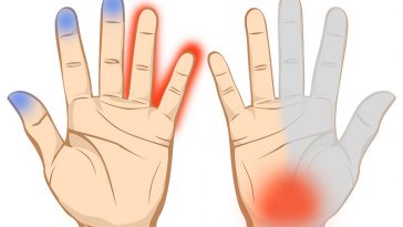 7 Important Things Your Hands are Trying to Tell You About Your Health