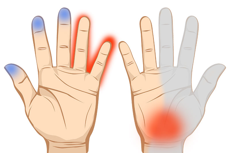 7 Important Things Your Hands are Trying to Tell You About Your Health