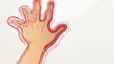 Why Your Hands Shake and What You Can Do About It