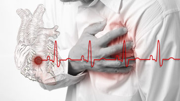 7 Hidden Heart Attack Risks And Ways To Avoid Them