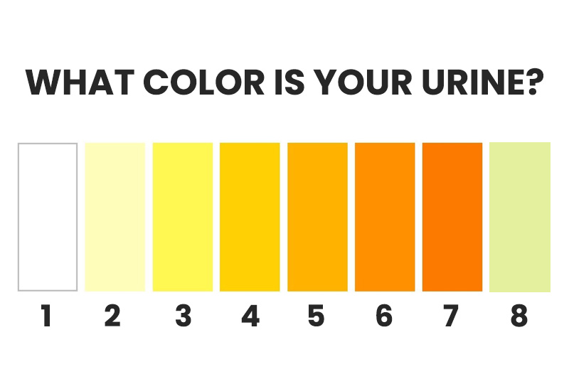 What the Color of Your Urine Reveals About Your Health